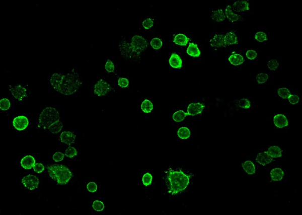 Recombinant TROP2/TACSTD2 Monoclonal Antibody (AN300335P)