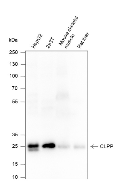 Recombinant CLPP Monoclonal Antibody (AN301496L)