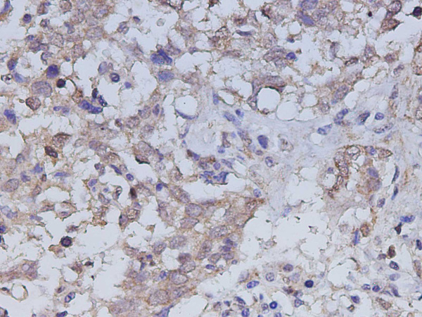 ILK Polyclonal Antibody (D-AB-10466L)