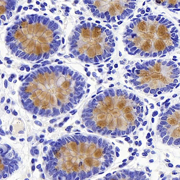 MUC2 Polyclonal Antibody (E-AB-70212)