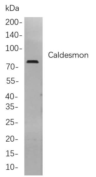 Recombinant Caldesmon Monoclonal Antibody (AN300893L)