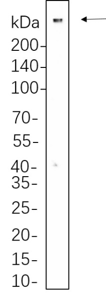 Recombinant 53BP1 Monoclonal Antibody (AN301369L)