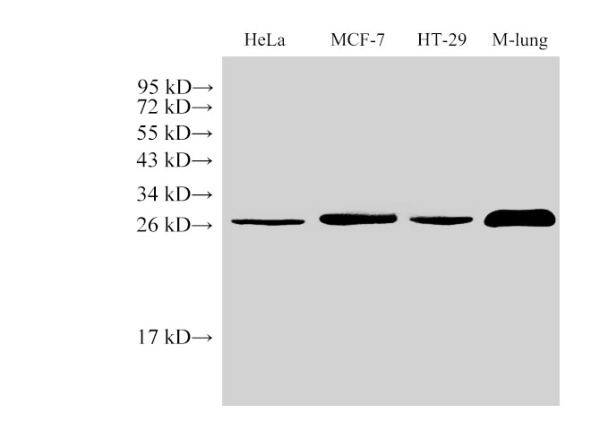 Galectin 3 Polyclonal Antibody (E-AB-40350)