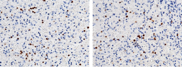 Recombinant Ficolin-1/Ficolin-A/FCN1 Monoclonal Antibody (AN300211P)