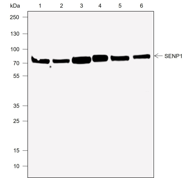 Recombinant SENP1 Monoclonal Antibody (AN302002L)