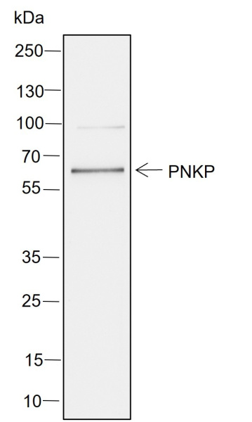 Recombinant PNKP Monoclonal Antibody (AN302032L)