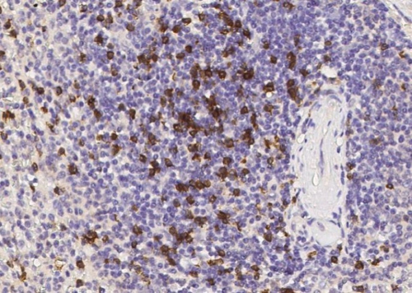 Recombinant CD8B/P37/LEU2 Monoclonal Antibody (AN300216P)