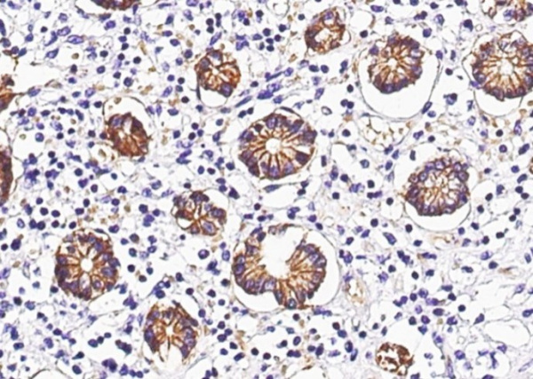 Recombinant GPA33 Monoclonal Antibody (AN300125P)
