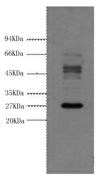 Galectin 3 Monoclonal Antibody (E-AB-22006)