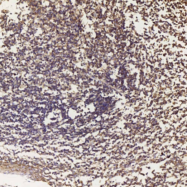 BECN1 Polyclonal Antibody (E-AB-70093)