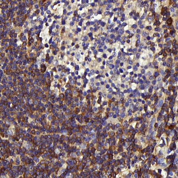 c-Kit Polyclonal Antibody (E-AB-70350)