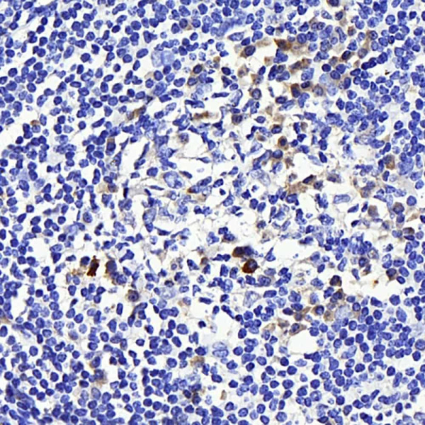 CD169 Polyclonal Antibody (E-AB-70160)
