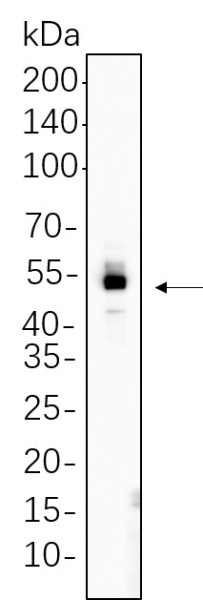Recombinant Smad5 Monoclonal Antibody (AN300705L)