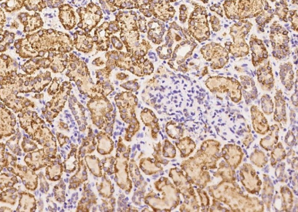 Recombinant GCSH Monoclonal Antibody (AN300279P)