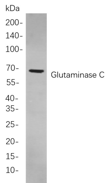 Recombinant Glutaminase C Monoclonal Antibody (AN301062L)