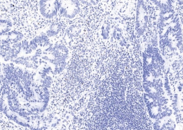 FOXP3 Monoclonal Antibody (AN200062P)