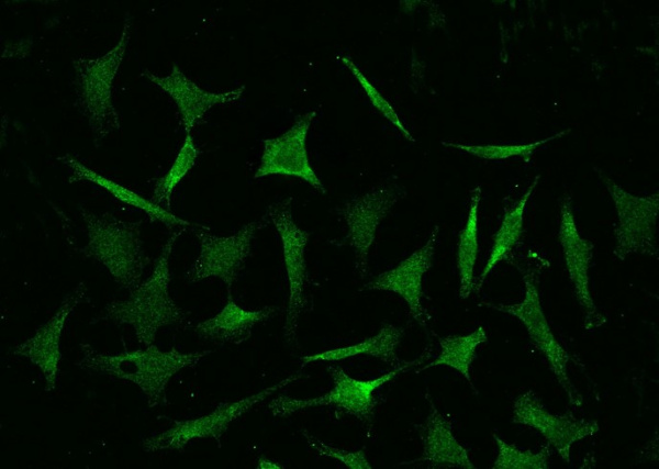 COMMD9 Monoclonal Antibody (AN200243P)