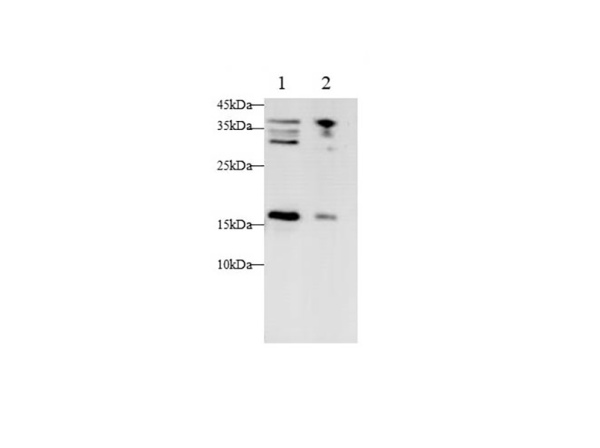 CDKN2A Polyclonal Antibody (AN005860L)