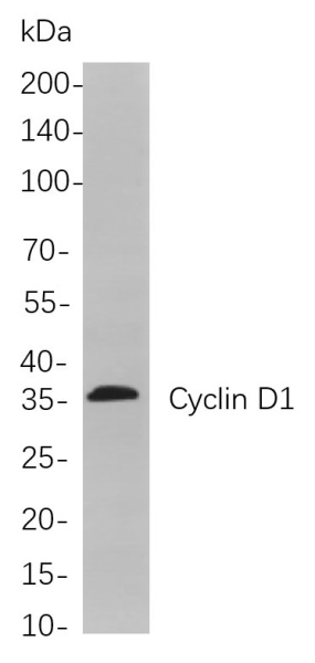 Recombinant Cyclin D1 Monoclonal Antibody (AN301028L)