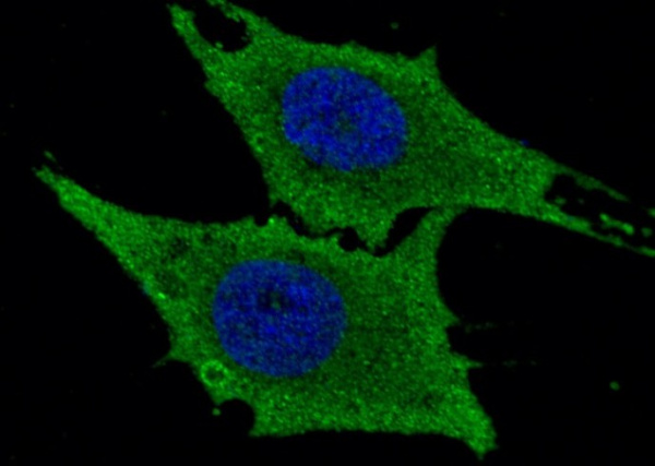 Recombinant Leukotriene A4 Hydrolase/LTA4H Monoclonal Antibody (AN300111P)