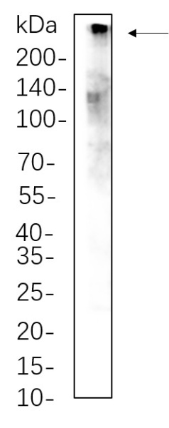 Recombinant CREBBP Monoclonal Antibody (AN301352L)