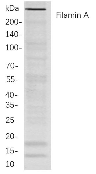 Recombinant Filamin A Monoclonal Antibody (AN300953L)