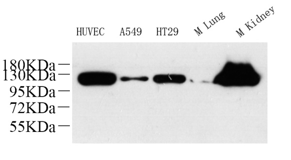 ITGAV Polyclonal Antibody (E-AB-70152)