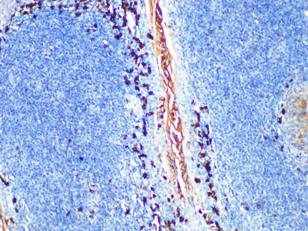 IgA Monoclonal Antibody (ELAB6964-R)
