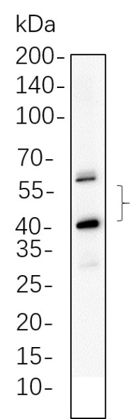 Recombinant JNK2 Monoclonal Antibody (AN300611L)