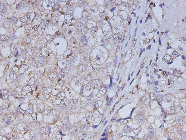 ABL1 Polyclonal Antibody (D-AB-10470L)