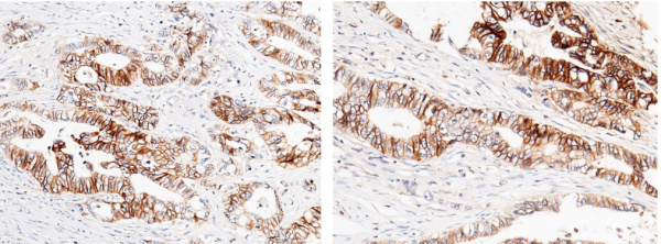 Cadherin-17/LI-cadherin/CDH17 Monoclonal Antibody (AN200119P)