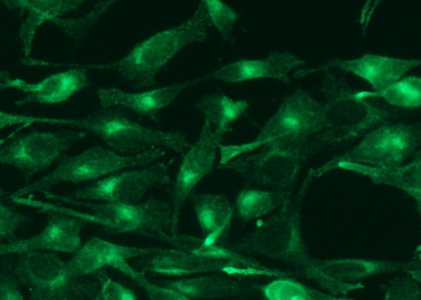 Recombinant Transferrin Receptor/TFRC/CD71 Monoclonal Antibody (AN300362P)