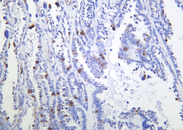 Recombinant Phospho-CDK1, 2 (Thr14) Monoclonal Antibody (AN301145L)