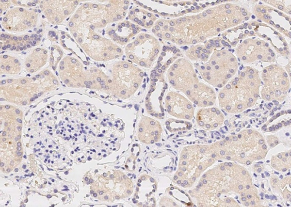 Epiphycan/DSPG3 Monoclonal Antibody (AN200232P)
