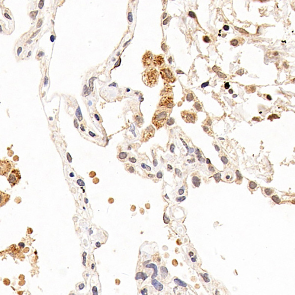 CXCR7 Polyclonal Antibody (E-AB-70115)
