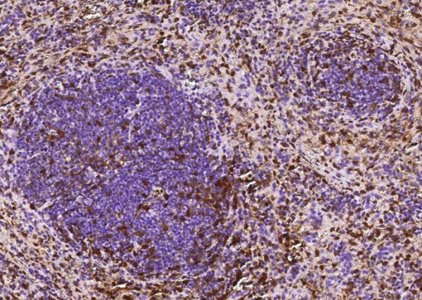 Recombinant S100A6/Calcyclin/CACY Monoclonal Antibody (AN300494P)