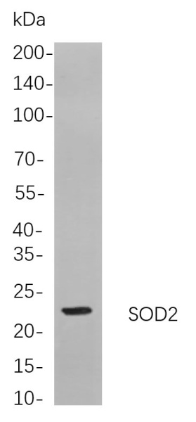 Recombinant SOD2 Monoclonal Antibody (AN300961L)