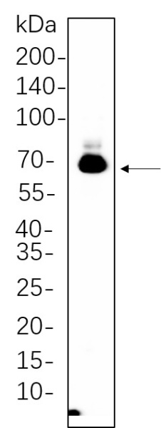 Recombinant BACE Monoclonal Antibody (AN301340L)