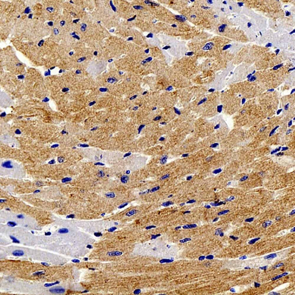 TNNT2 Polyclonal Antibody (E-AB-70232)
