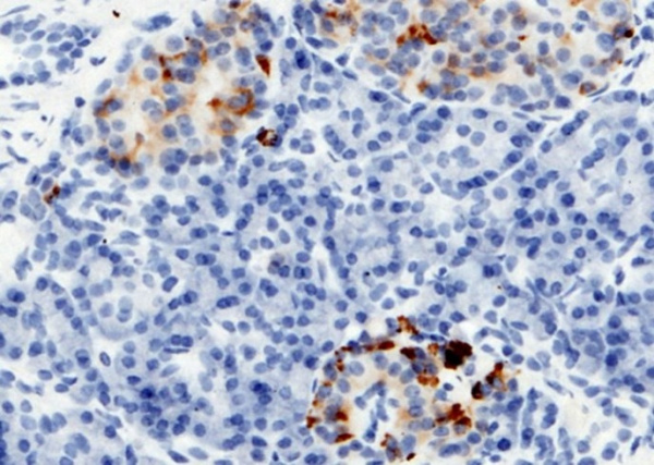 RBP4 Monoclonal Antibody (AN200017P)