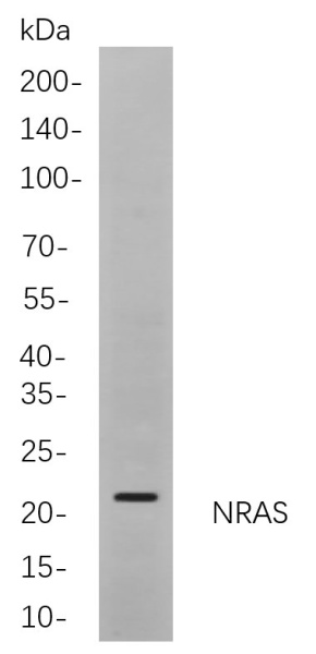 Recombinant NRAS Monoclonal Antibody (AN300969L)