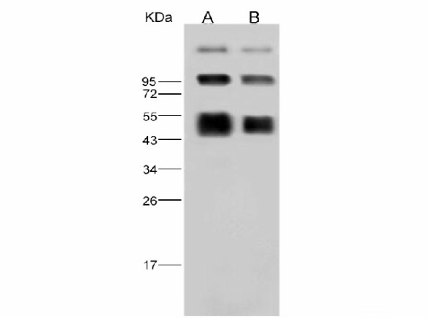 Anti-Dengue virus DENV-2(Strain New Guinea C) NS1 Polyclonal Antibody (E-AB-V1066)