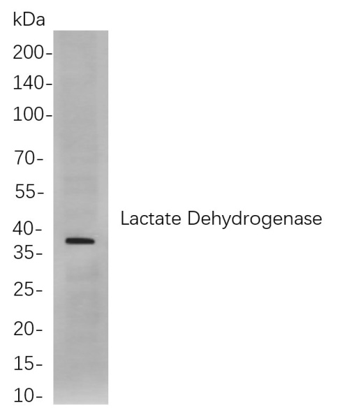 Recombinant Lactate Dehydrogenase Monoclonal Antibody (AN301068L)