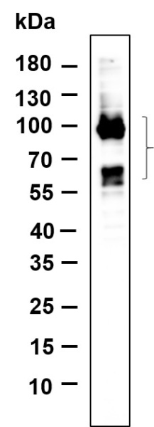 Recombinant Phospho-Tau (Ser396) Monoclonal Antibody (AN301134L)