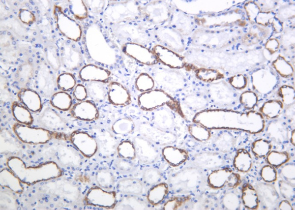 Recombinant PAI-1 Monoclonal Antibody (AN301284L)