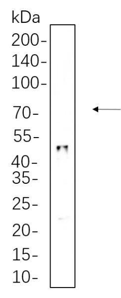 Recombinant HNF-3α Monoclonal Antibody (AN300731L)