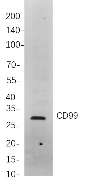 Recombinant CD99 Monoclonal Antibody (AN300984L)