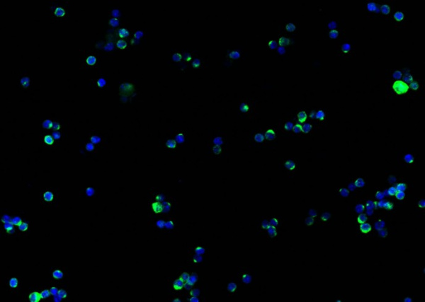 Recombinant IFN gamma Monoclonal Antibody (AN300548P)