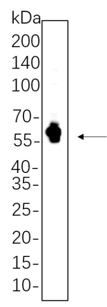 Recombinant Tau Monoclonal Antibody (AN300622L)