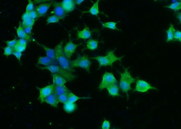 Recombinant CNDP1 Monoclonal Antibody (AN300122P)